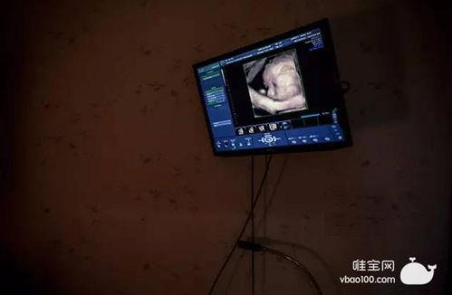 美国产房生孩子视频直播-第1张图片-亚洲高清影视网 美国产房生孩子视频直播-第1张图片-亚洲高清影视网